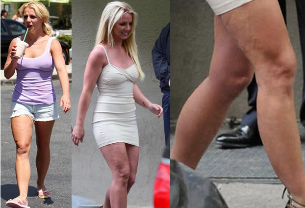 Celebrity cellulite: Britney Spears cellulite