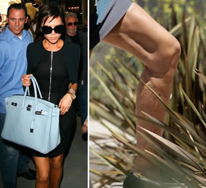 Celebrity diet: Victoria Beckham busted with cellulite