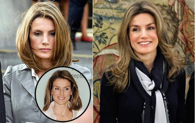 Celebrity Surgery: Queen Letizia Ortiz's surgery