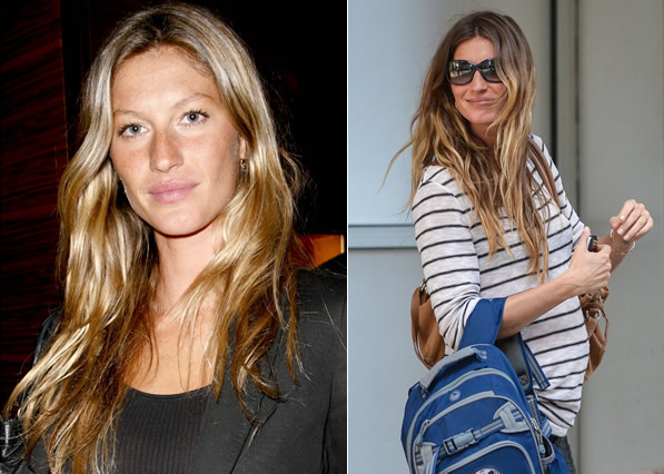 Celebrity cosmetic surgery: Gisele Bundchen